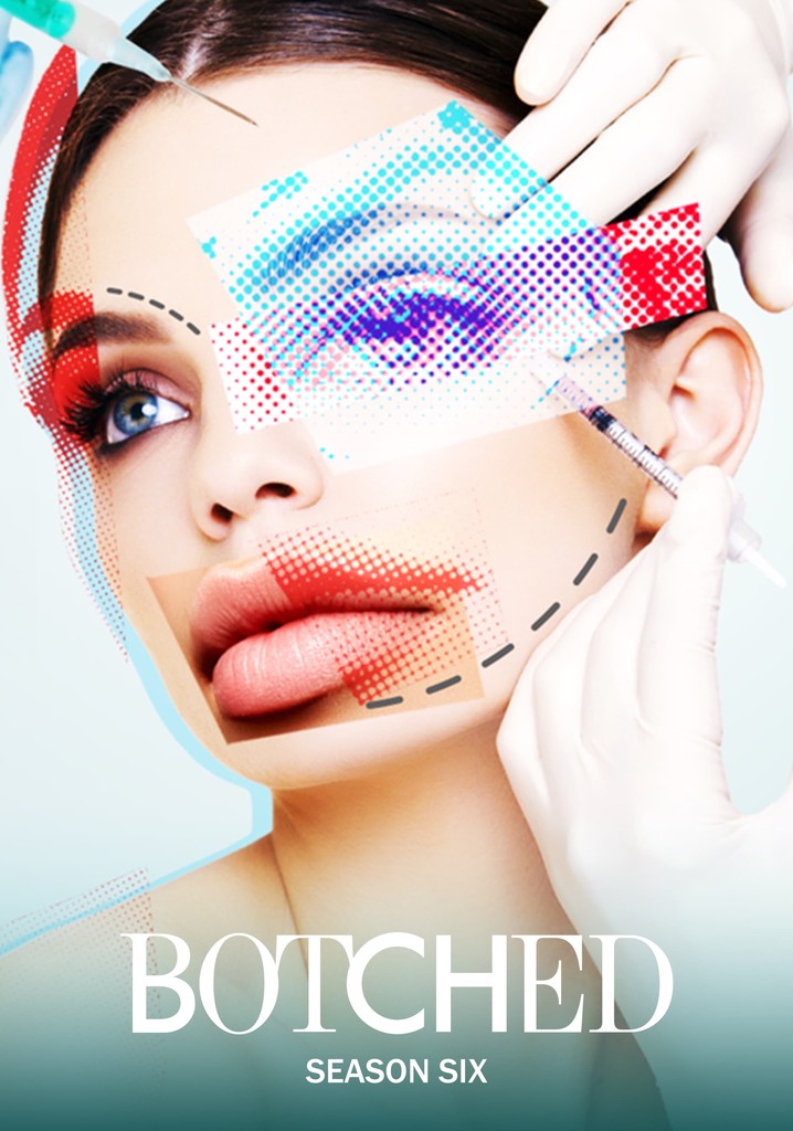 Botched Season 6 Watch Full Episodes Streaming Online